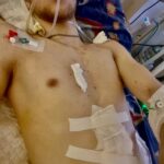Зображення посту: «Я йшов і не знав, чи ще живий»: як військовий з Луганщини відновлюється після підриву на розтяжці