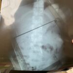 Зображення посту: «Я йшов і не знав, чи ще живий»: як військовий з Луганщини відновлюється після підриву на розтяжці