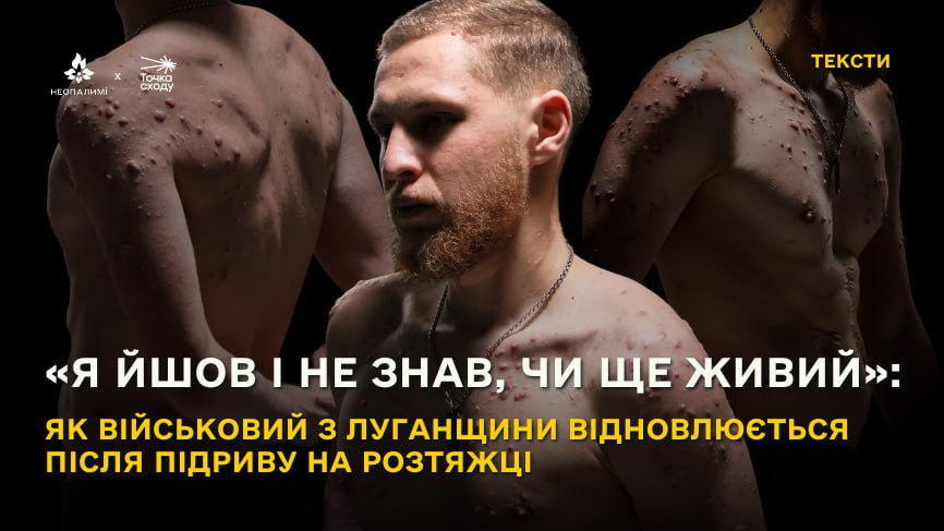 Зображення посту: «Я йшов і не знав, чи ще живий»: як військовий з Луганщини відновлюється після підриву на розтяжці
