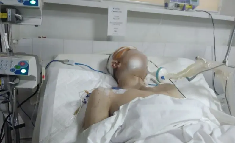 Зображення посту: Стало відомо про стан постраждалих підлітків у Краматорську